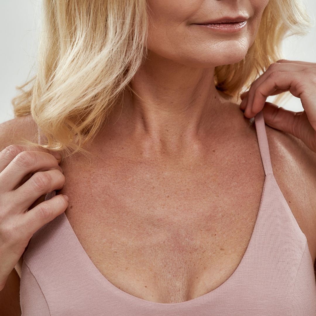 włókniaki na dekolcie